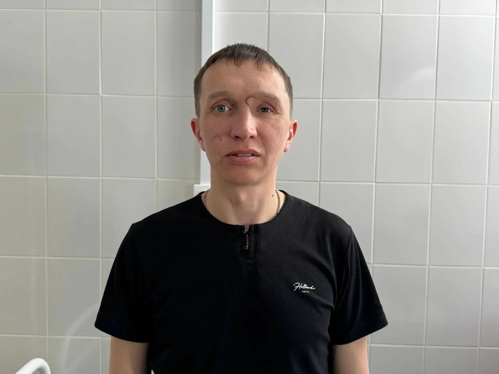 В Башкирии ветерану СВО провели цикл пластических операций